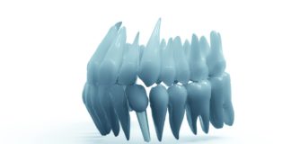 Implant dentar in Bucuresti