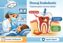 Drenajul endodontic: unde se poate realiza și când devine necesar clinicadrrizoiu.ro