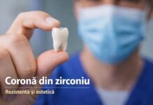 Motive pentru care să optați pentru o coroană din zirconiu Clinica stomatologica sector 6